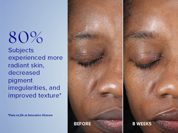 IS CLINICAL Active Peel System