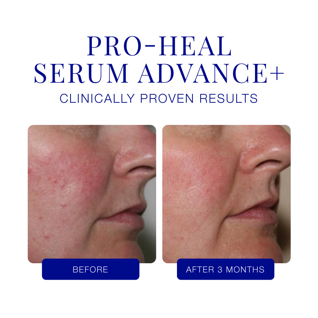 IS CLINICAL Pro-Heal Serum Advance+