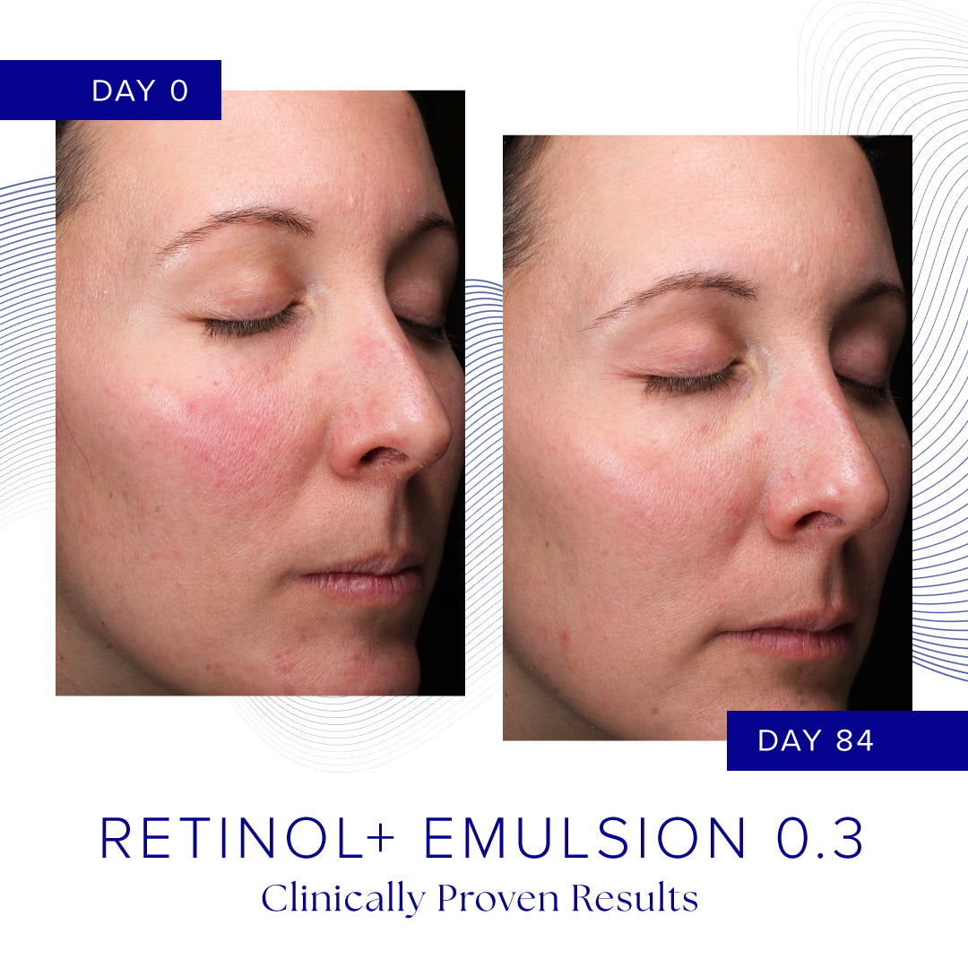 IS CLINICAL Retinol+ Emulsion 0.3
