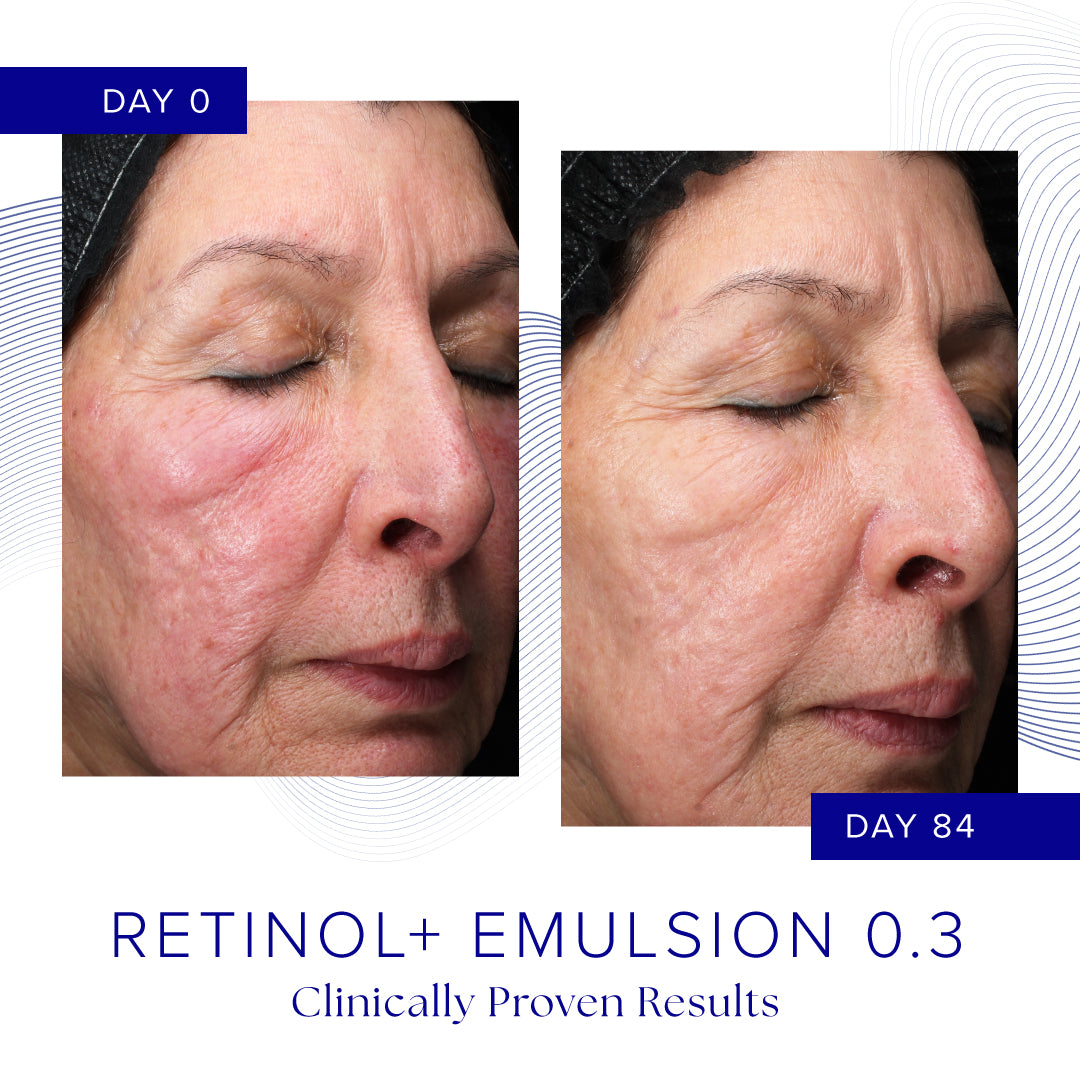 IS CLINICAL Retinol+ Emulsion 0.3