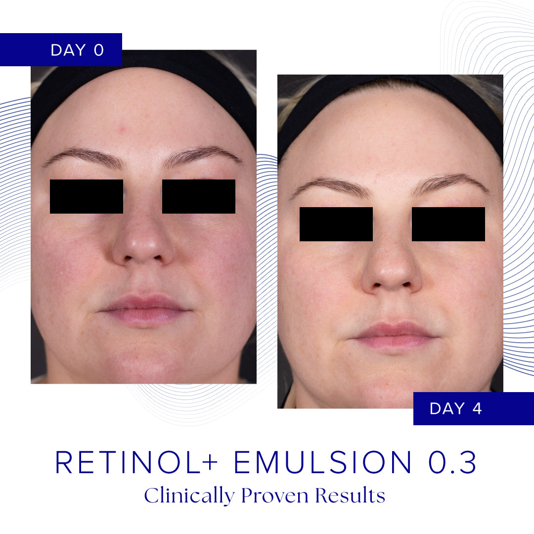 IS CLINICAL Retinol+ Emulsion 0.3